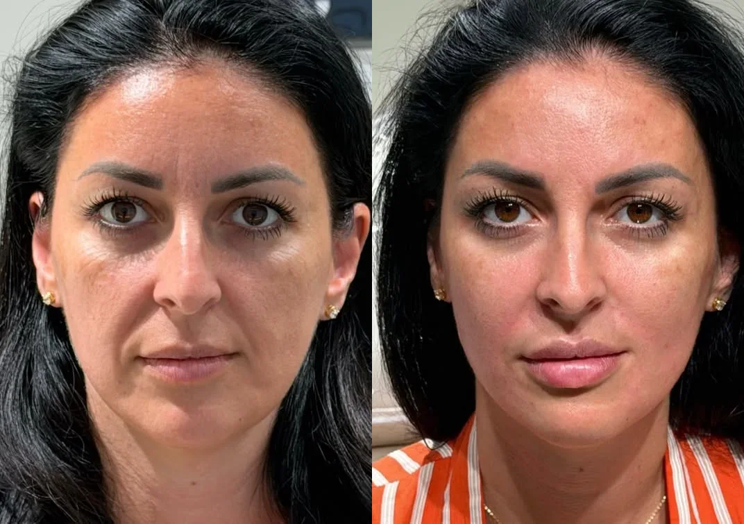 Jagodice i srednja trećina — rezultat