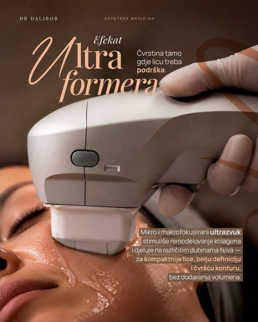 Ultraformer III — lice