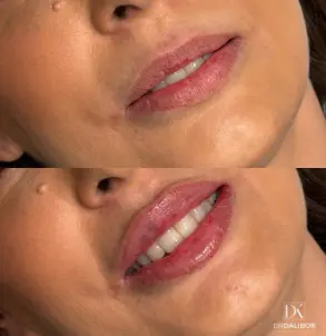 Dr Dalibor Lips — pre i posle — rezultat 1