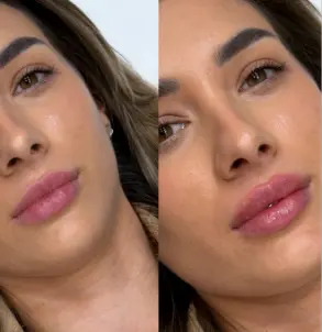Dr Dalibor Lips — pre i posle — rezultat 6