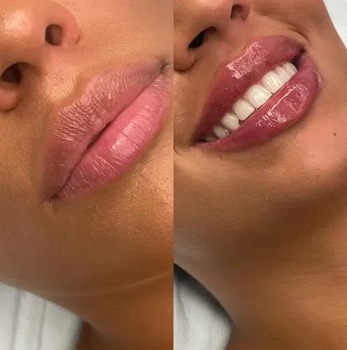 Dr Dalibor Lips — pre i posle — rezultat 7