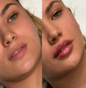 Dr Dalibor Lips — pre i posle — rezultat 3