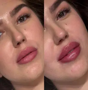 Dr Dalibor Lips — pre i posle — rezultat 4