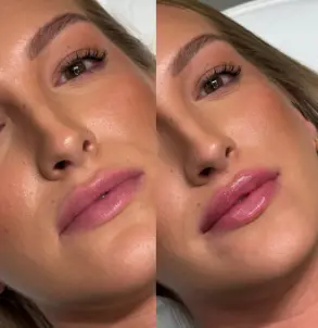 Dr Dalibor Lips — pre i posle — rezultat 5